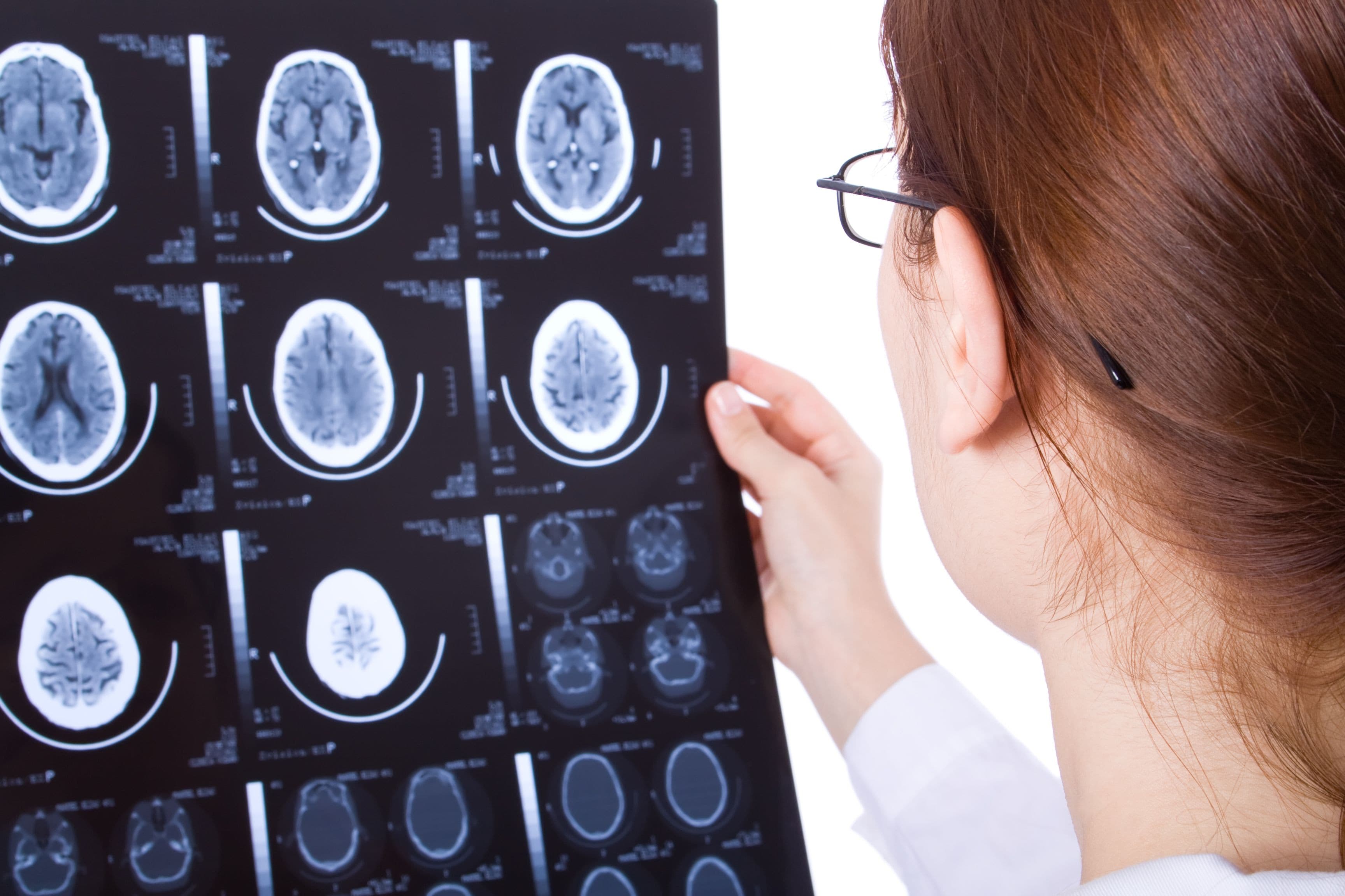 Brain Injury Checklist Brain Injury Checklist